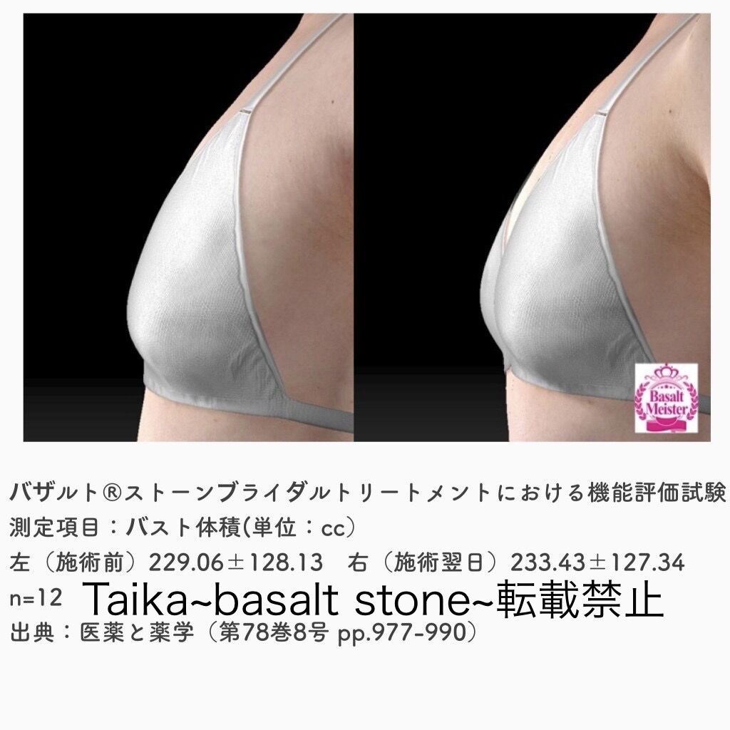 バザルト®ストーンブライダルトリートメント前後のバスト容量の変化を示す検証画像
