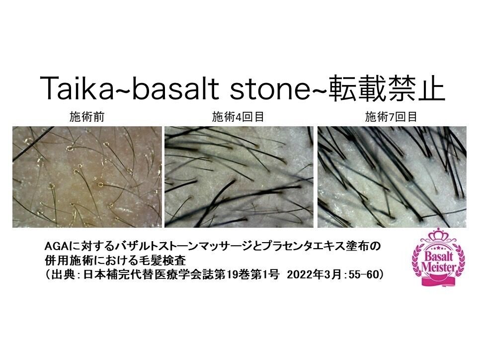 バザルト®ストーンマッサージとプラセンタエキス塗布の併用施術による発毛効果(施術前・4回目・7回目)